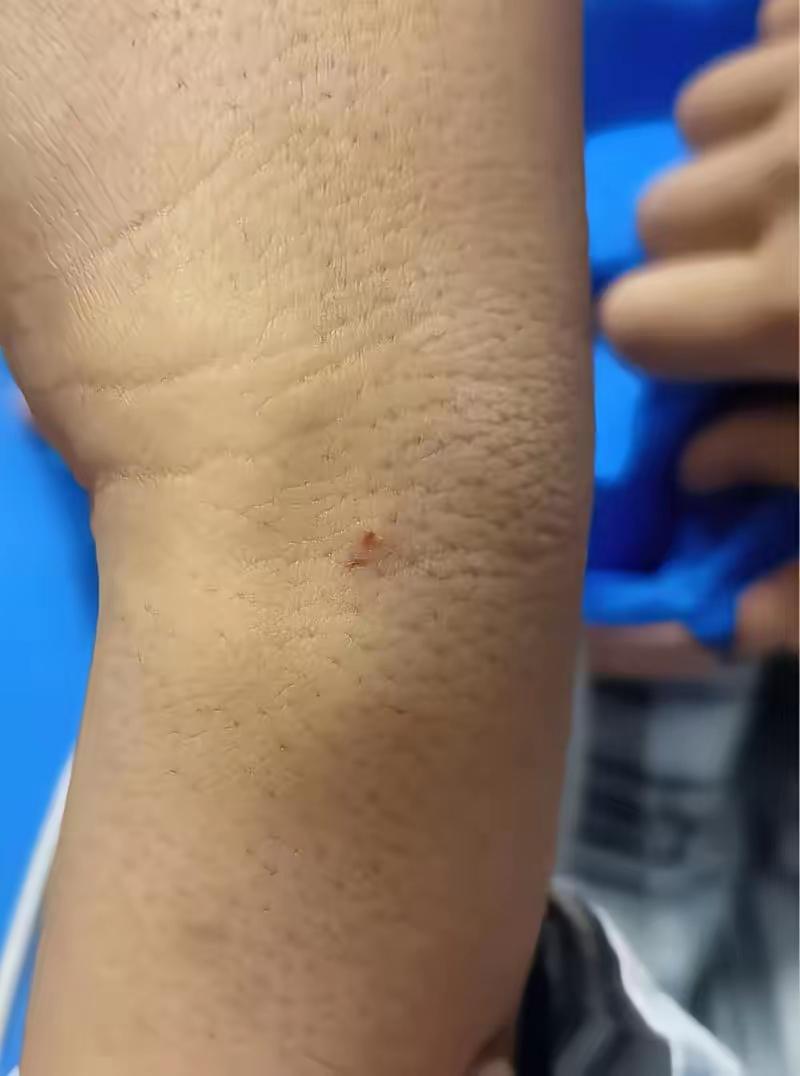湖南，一9岁男童在学校操场玩耍，竟被剧毒短尾蝮蛇咬伤，老师发现后，第一时间不是打