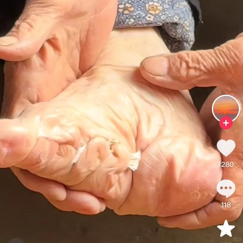 女性应该看看此贴：断足式裹脚有多可怕、又是从何时开始流行的？宋明两朝流行的裹足是