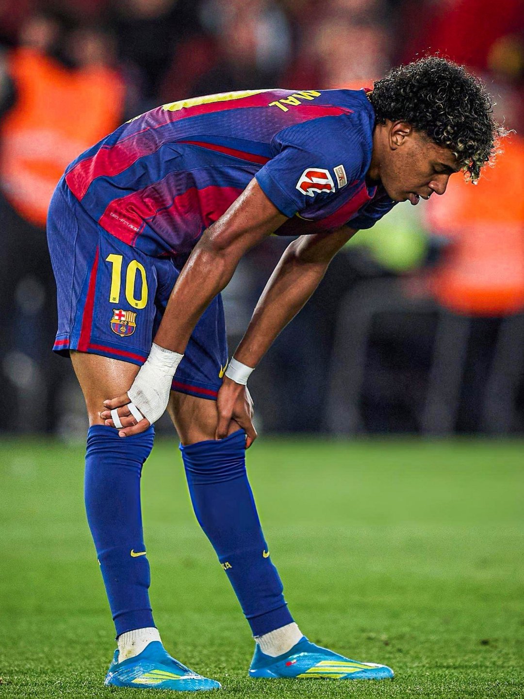 塞尔电台：亚马尔受伤部位的撕裂程度分3级，如果是1级撕裂将缺陷2-3周，2级撕裂