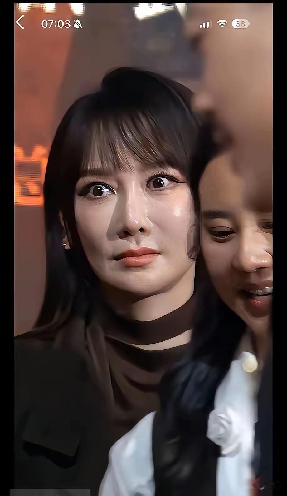 过度医美，会让脸显得很僵硬…