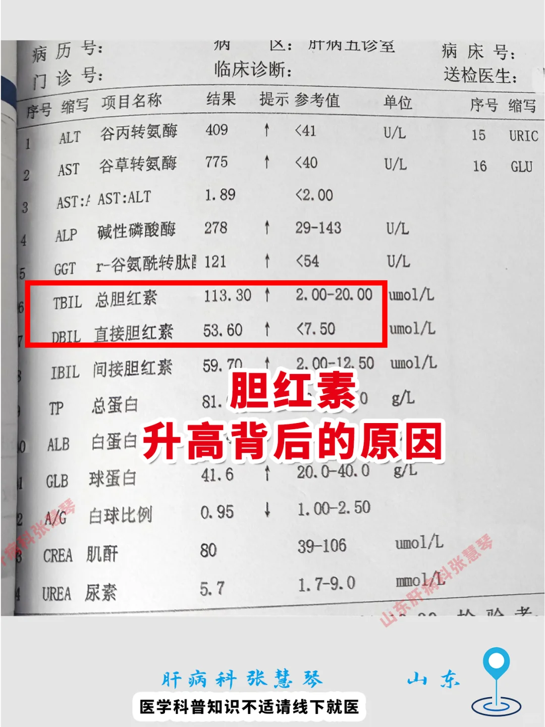 胆红素升高背后的原因，越早知道越好！