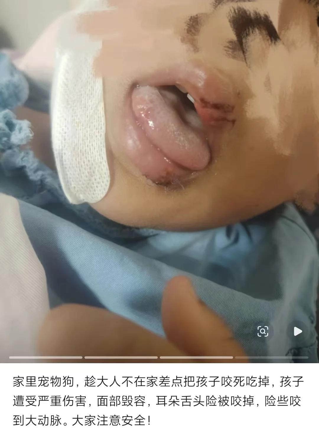 兔子急了还咬人，何况狗乎？
江苏徐州。
5岁男孩跟哈士奇玩，他把零食给狗，可能蹲
