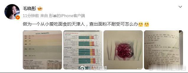 毛晓彤回应去医美诊所毛晓彤回应：“作为一个从小爱吃面食的天津人，查出面粉不耐受可
