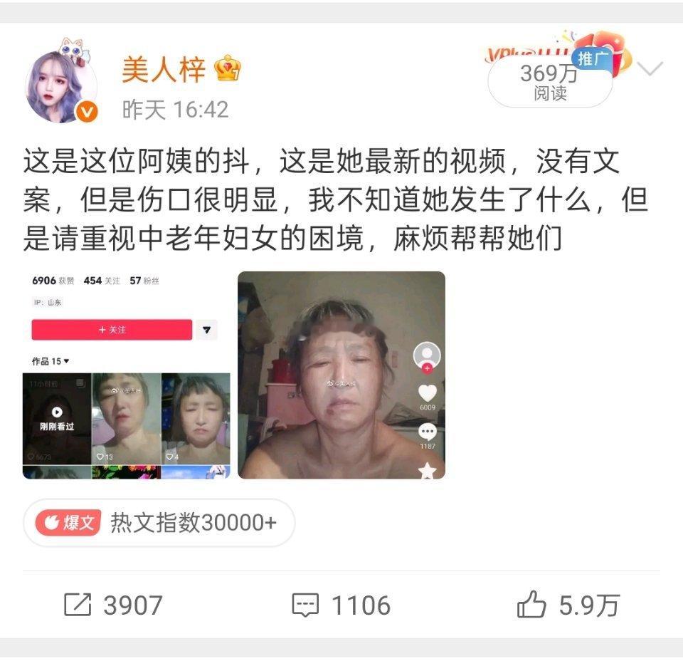 我没删，系统也没提示我被删了，只是就没有了，阿姨的抖好像也没了 