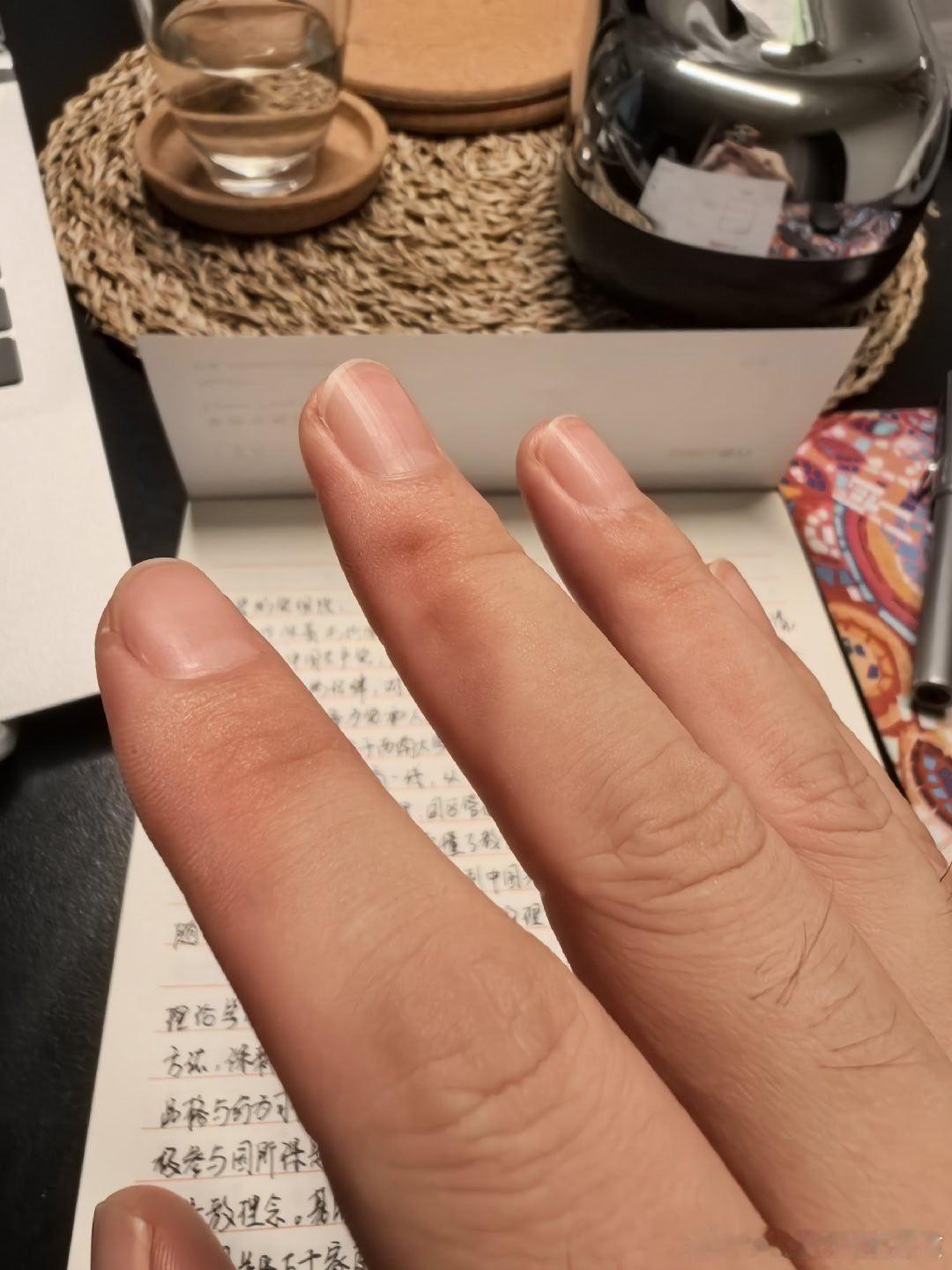 2180个字，写得我手都要断了有在小学半夜赶作业的既视感 