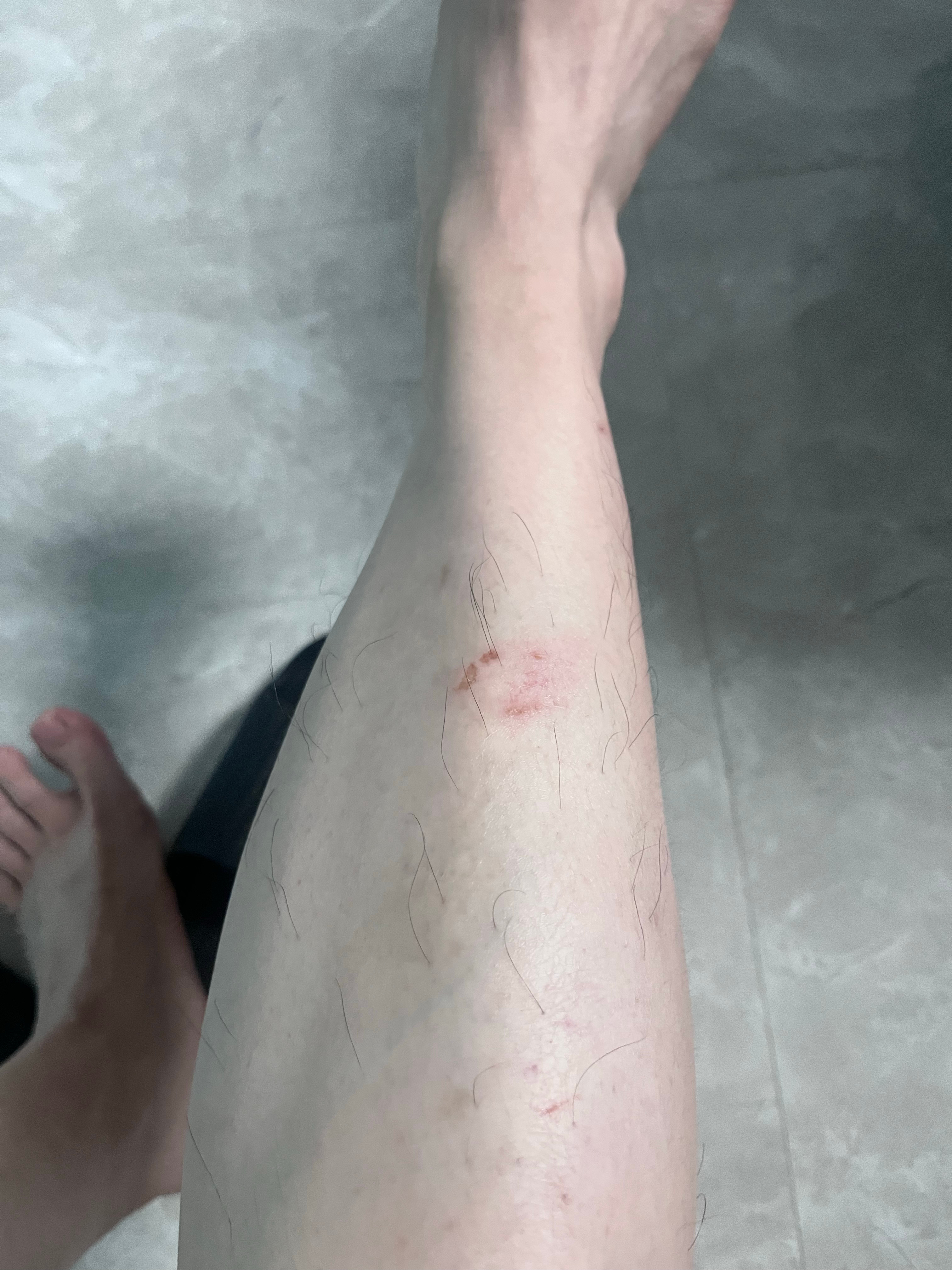 不喝了，不喝了，喝完滚楼梯，躺了一天。睡醒还在想昨天被谁打了