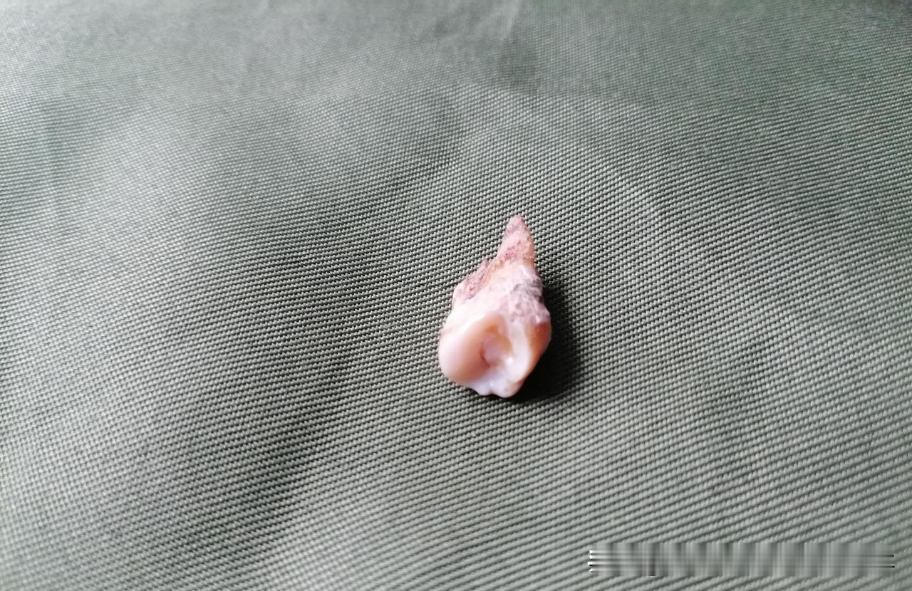 人体最坚硬的东西是什么？

牙齿！！

挖开坟墓，人体腐烂没了形，但牙齿却依然如
