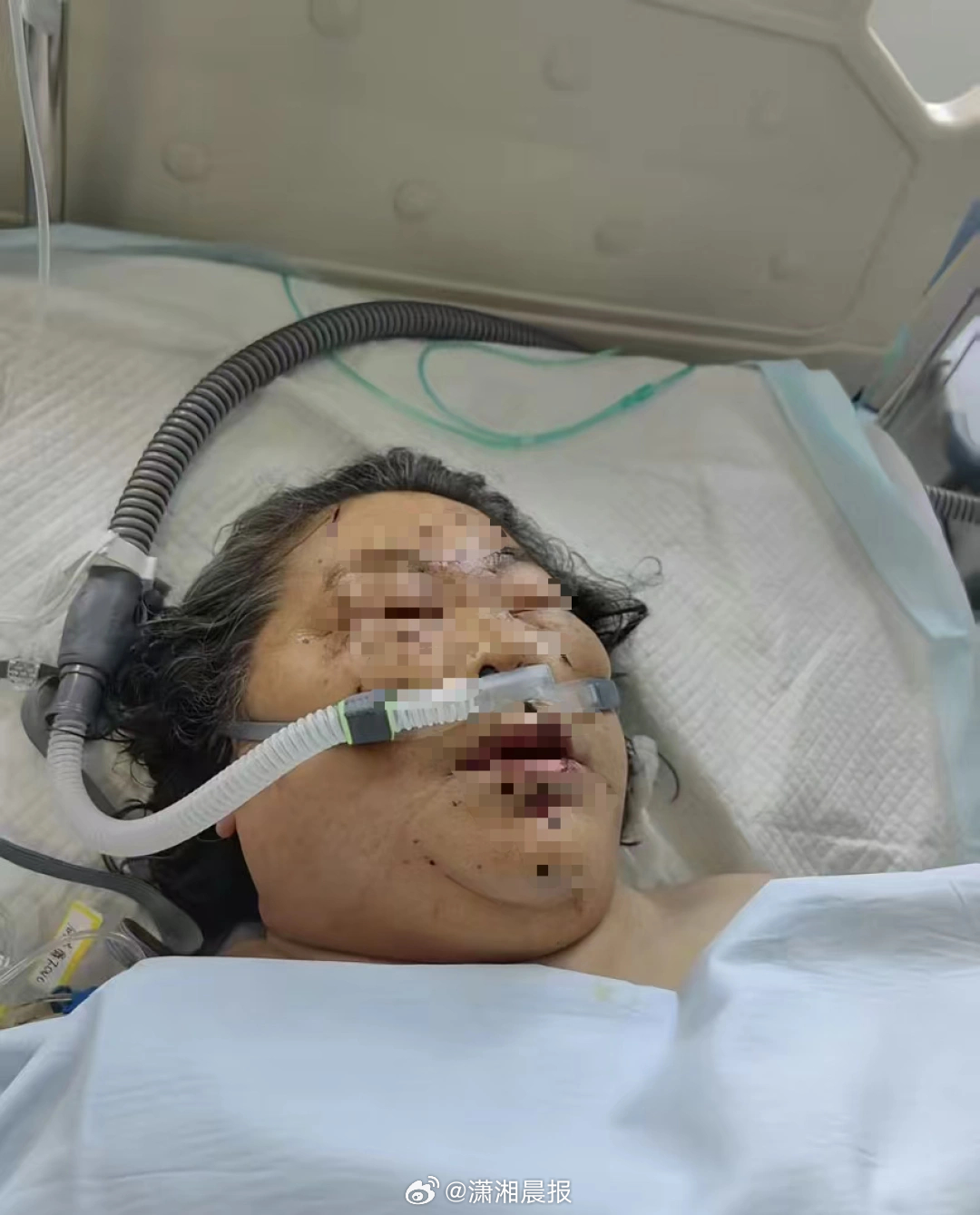 【湖北#70岁流浪动物之家负责人车祸进ICU#，#流浪动物之家负责人遭车祸义工发