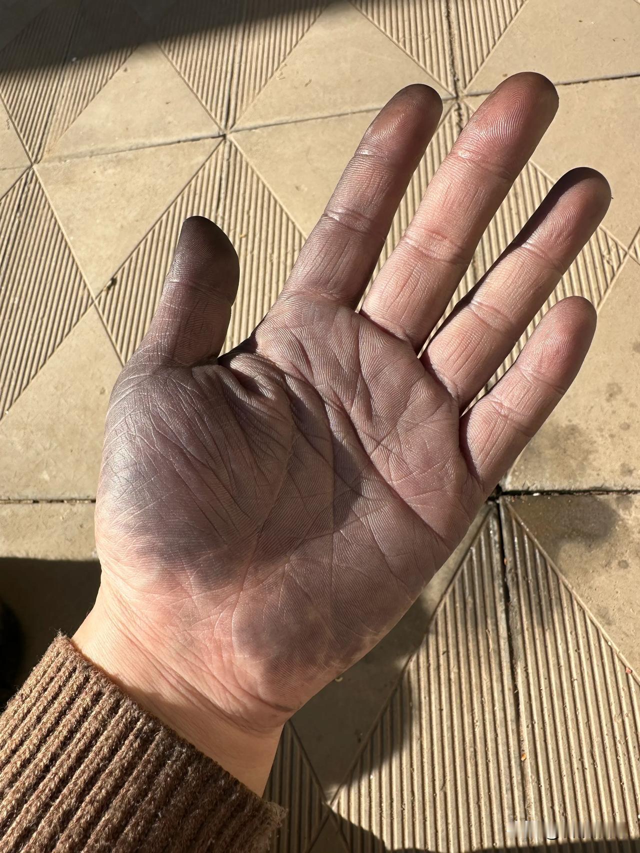 染头发把手染黑了，怎么洗都洗不干净，该咋办啊