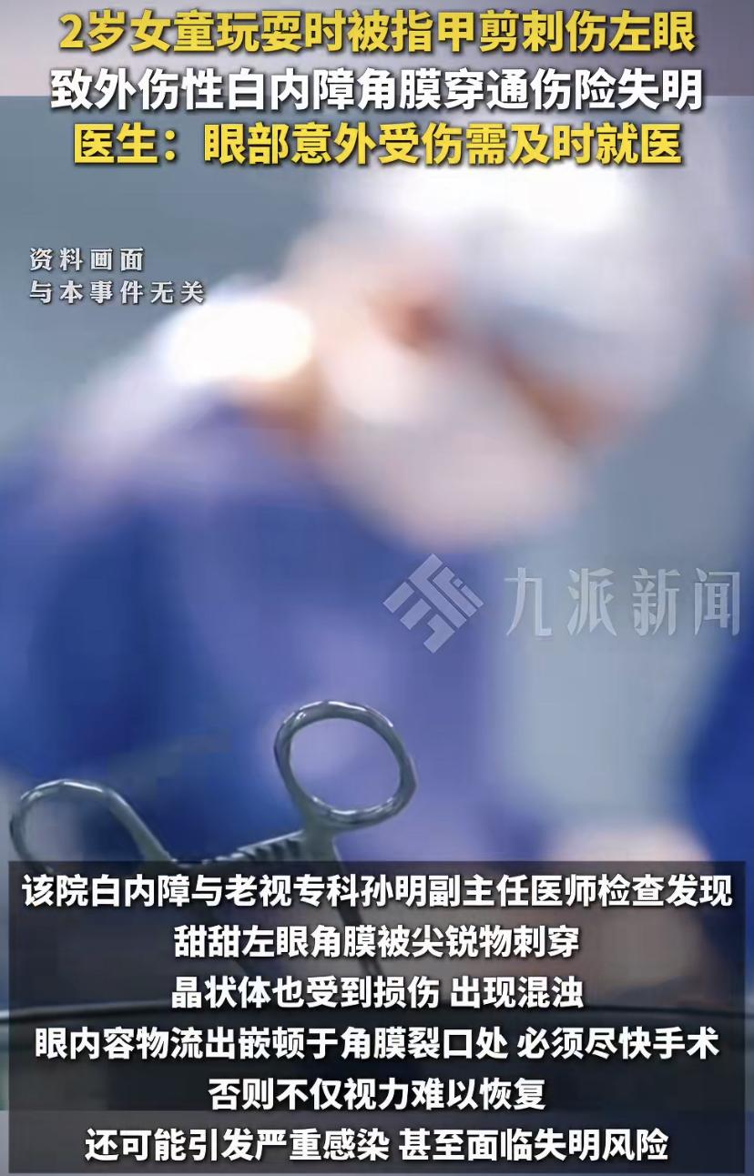 2岁女娃遭指甲剪"刺眼"，家长千万别犯这个错!
太吓人了!最近，2岁的小甜甜在家