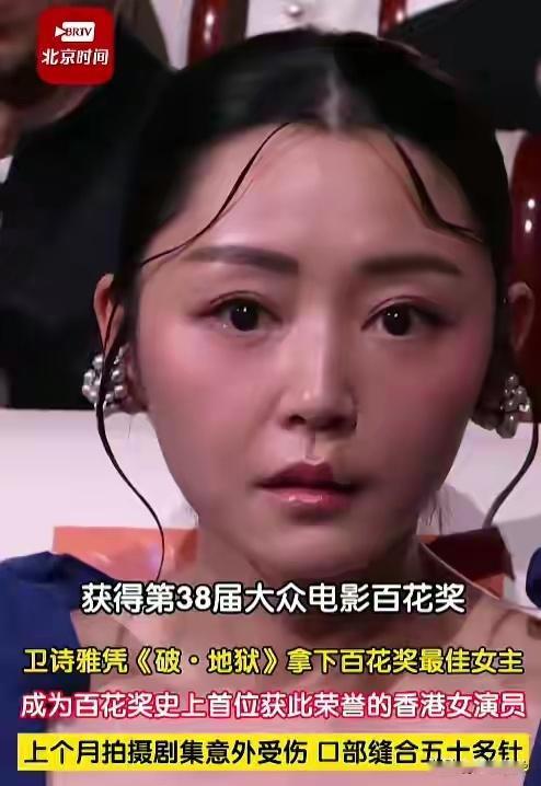 卫诗雅又传喜讯！41岁嫁普通人，为拍戏缝50多针，这一刻终于值了 