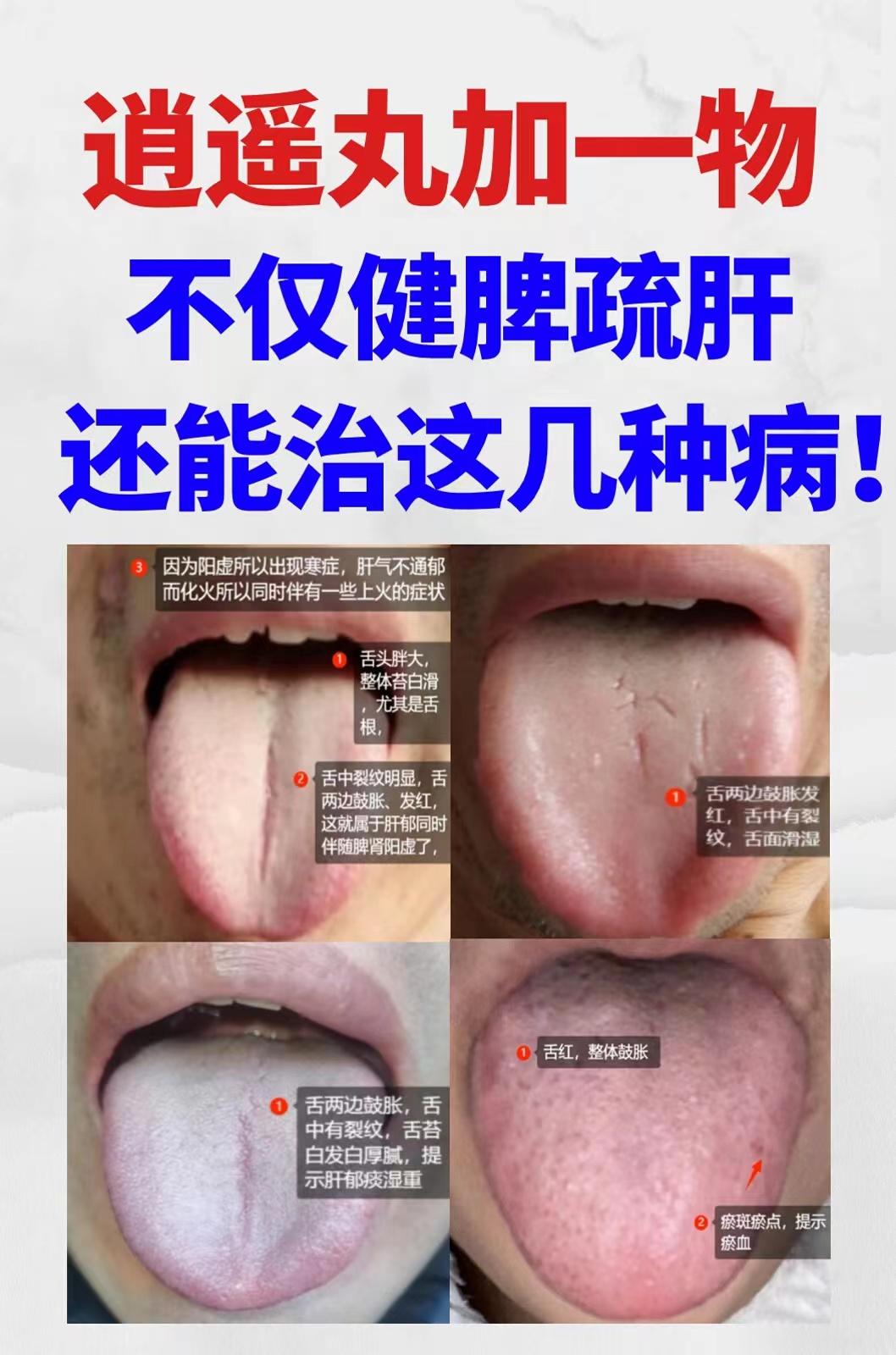 逍遥丸加一物，相信大家看过很多了！今天教你通过舌象，看看你适合哪一种搭配！#健康