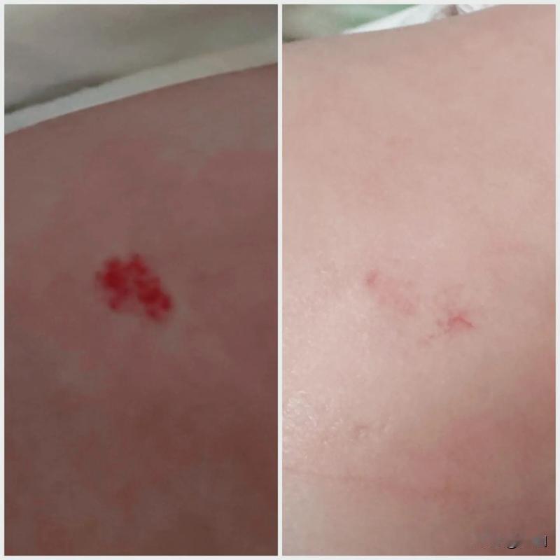 养小孩多费钱，主要是父母想给孩子最好的，是你你舍得给孩子买3883的药膏吗？
