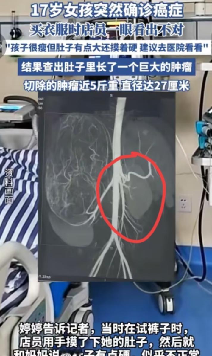 “幸亏发现了！”广东17岁女孩和妈妈一起逛街买衣服，在试裤子的时候，老板娘发觉女