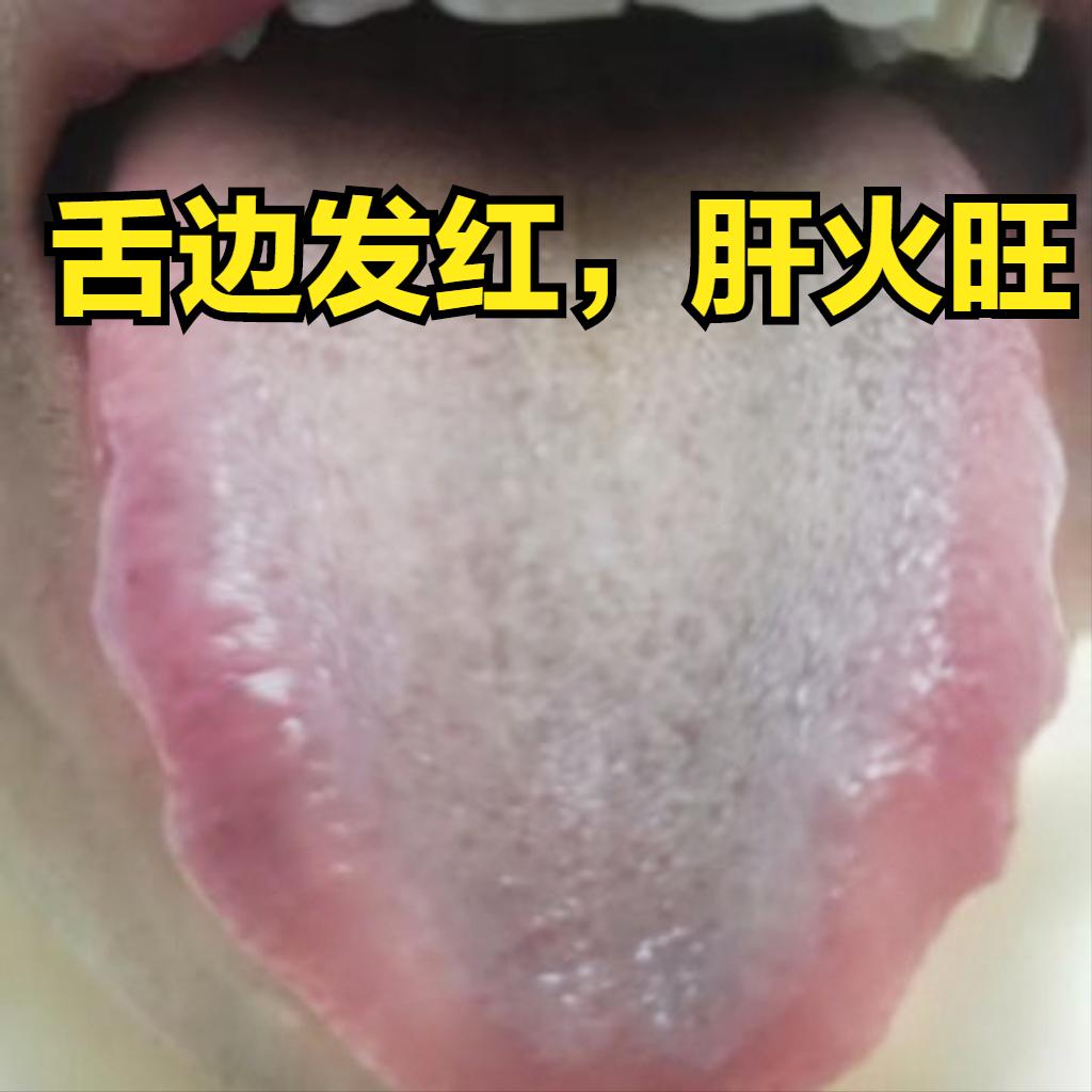 男人虚不虚，主要看这两点——舌边和舌根

1.舌边
在我们中医上讲，舌两边是肝脏