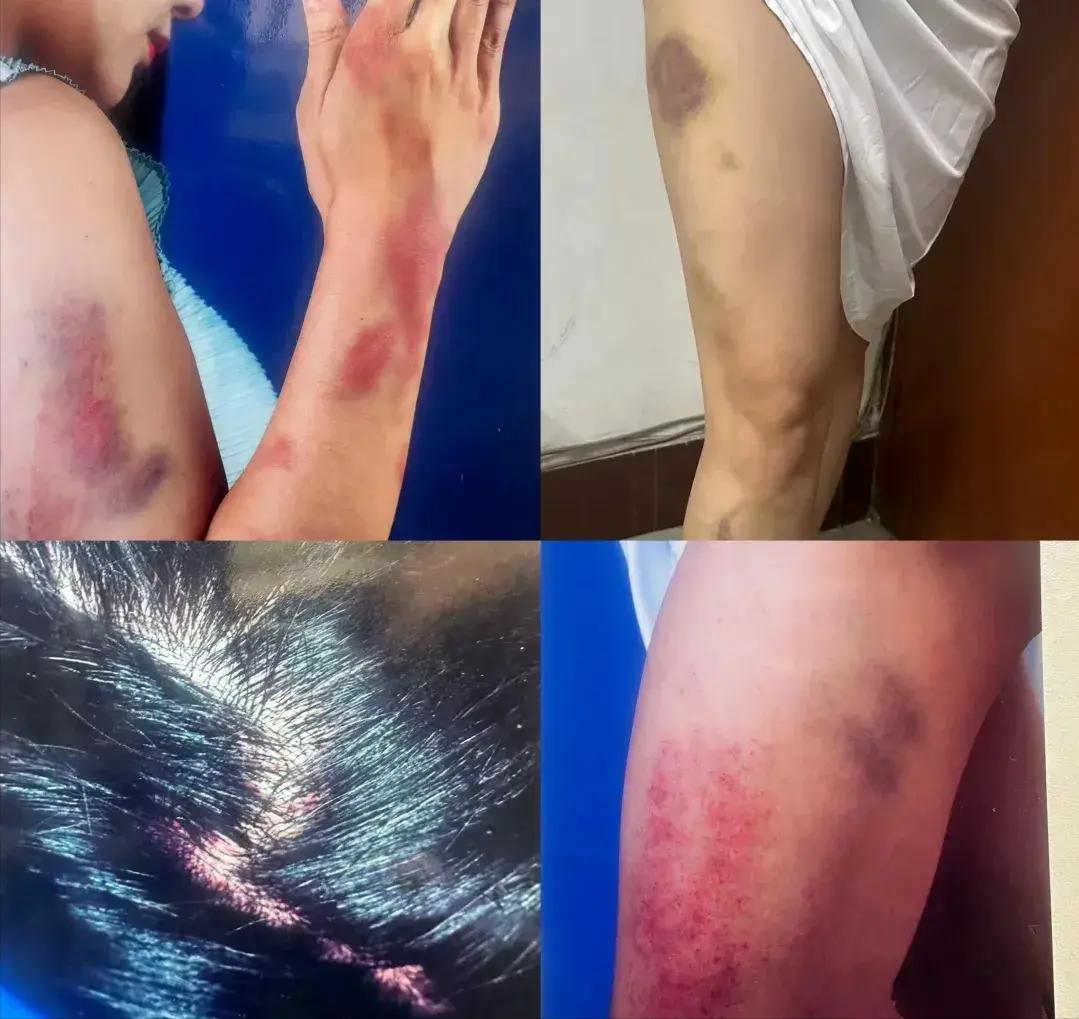突发消息！云南丽江一官员婚外情曝光，引发权力滥用质疑和社会信任危机。
这事儿啊，