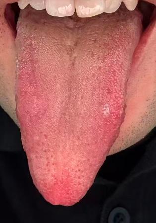 宗筋修复的根本：以纯净气血滋养，道理简单易懂






对于中医而言，存在就是