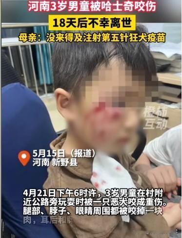 令人痛心！河南，3岁男童被恶犬咬伤，18天后不幸离世！男童母亲发声：“我儿子下个