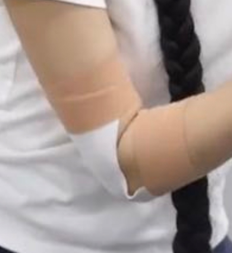 怎么这么多膏药