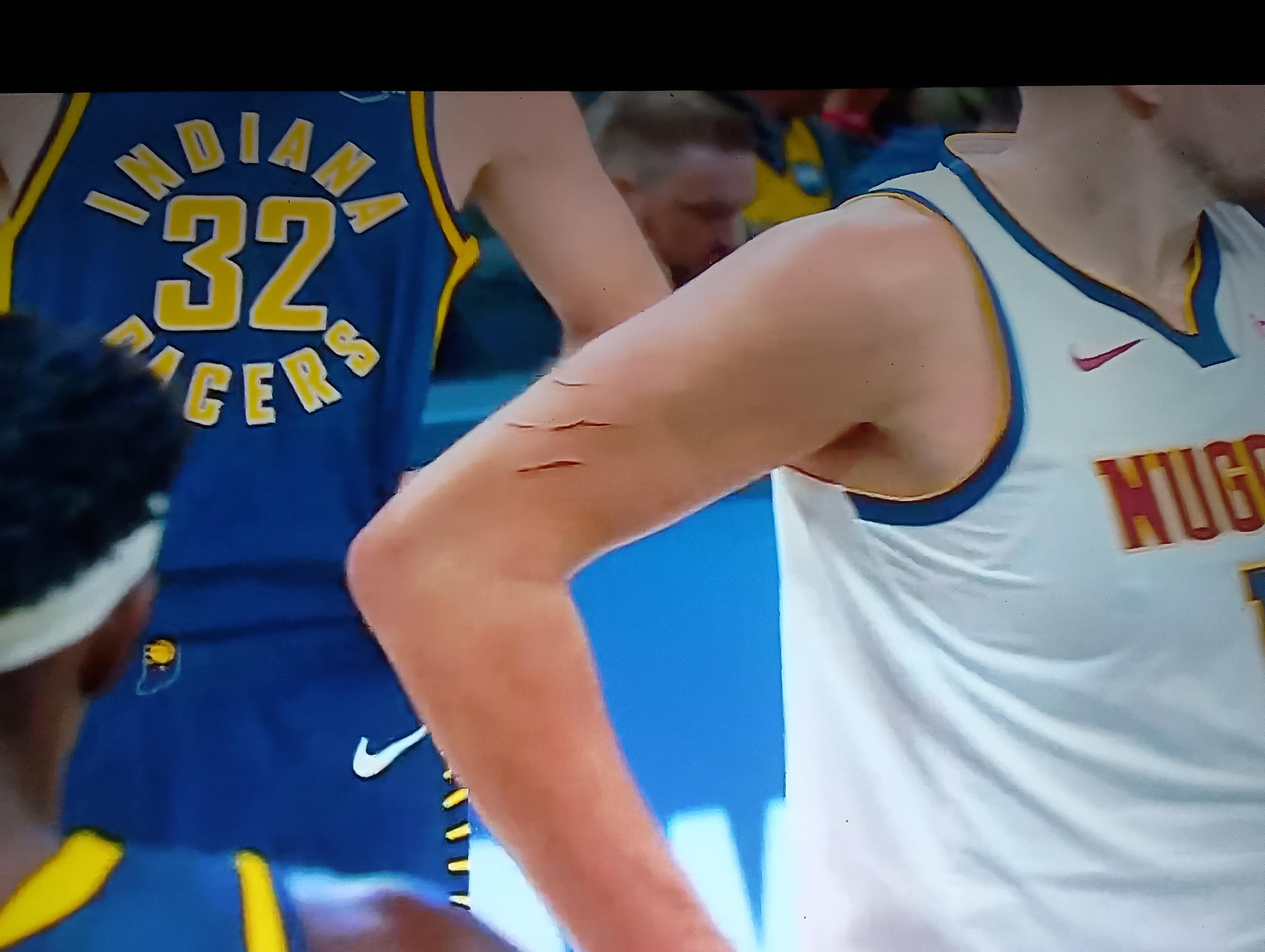 ▲约胖，你怎么手臂上还有猛龙的logo啊 