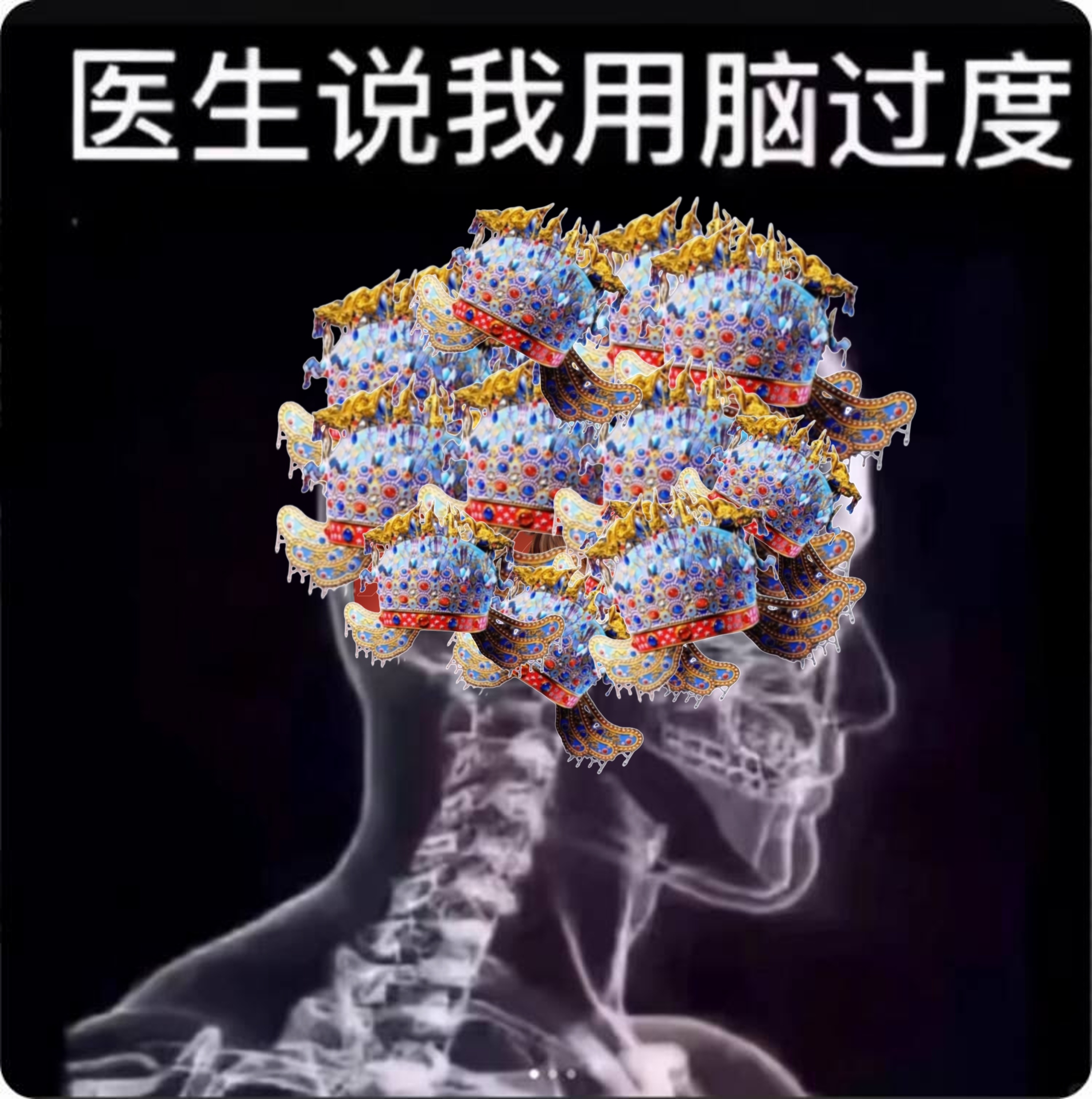 超自然行动组[超话]超自然行动组摸金就玩超自然超自然开棺大吉当伊森说我用脑过度时