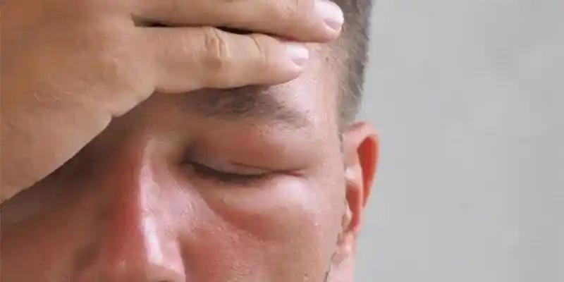 医生提醒：肺癌发出的首个信号，多半会呈现在脸上，很多人都不当回事！



“医生