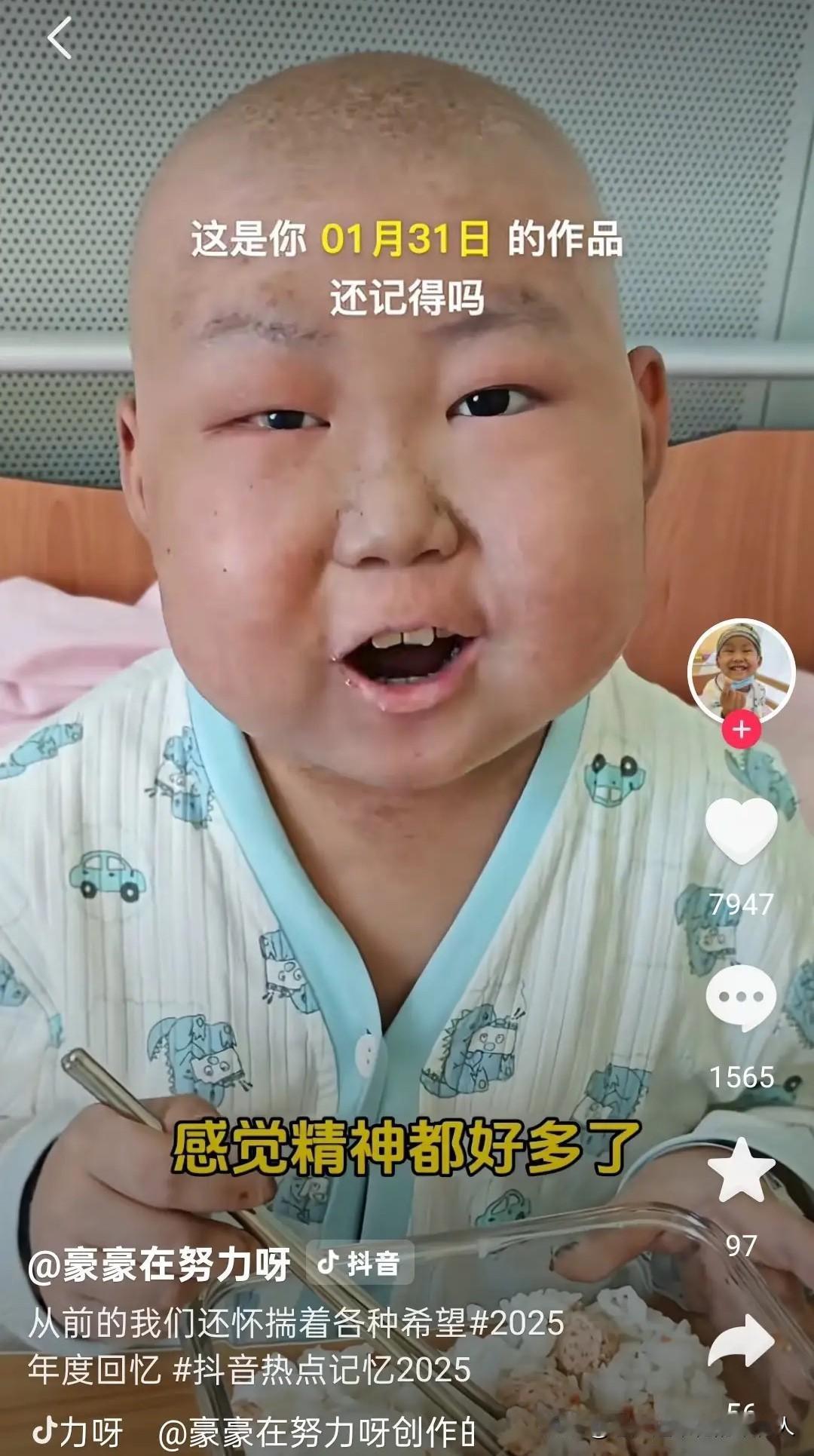 网红豪豪病情恶化，家人无奈放弃治疗，现在的原则就是他想吃啥就给啥。昨天他跟爸爸说