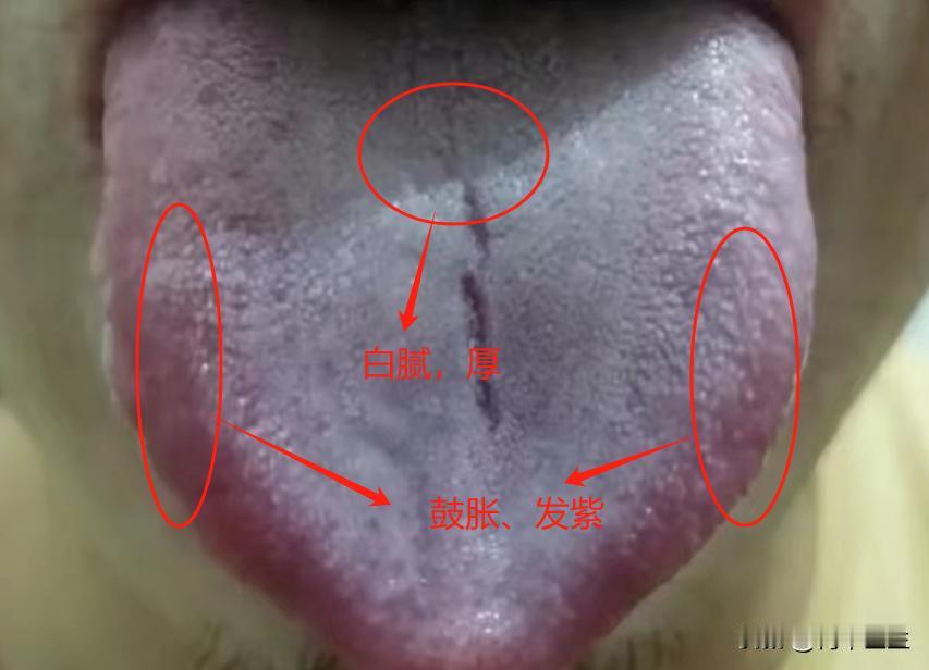 晚上一两点还睡不着，这个时候就要小心了

今天看诊了一位患者，他反应自己不是想熬