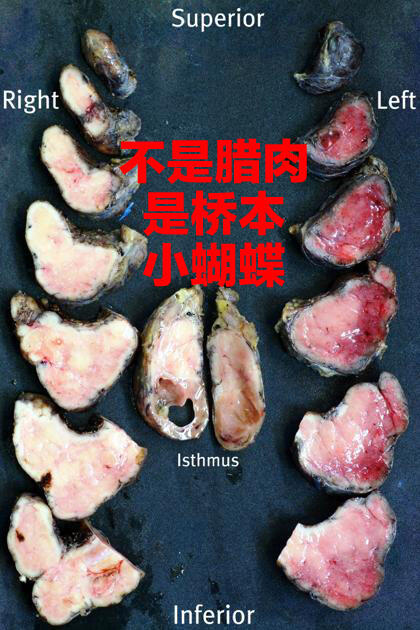 这不是腊肉，而是桥本的蝴蝶