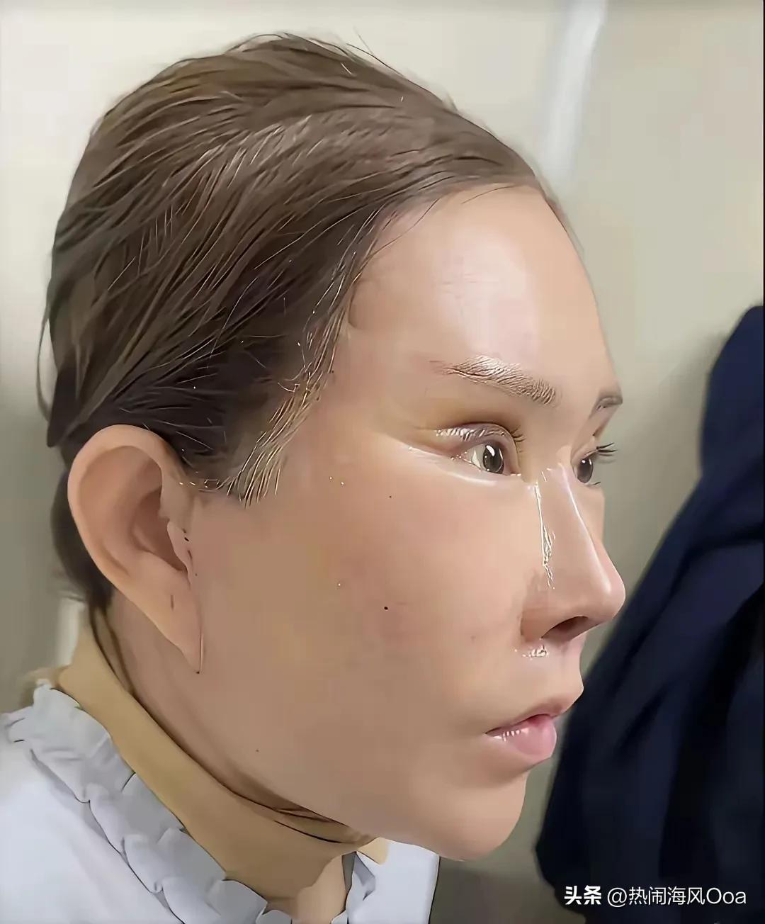 当下，有些50来岁的女人，开始实行“自救”了。义无反顾的加入了整脸美容的行列中。