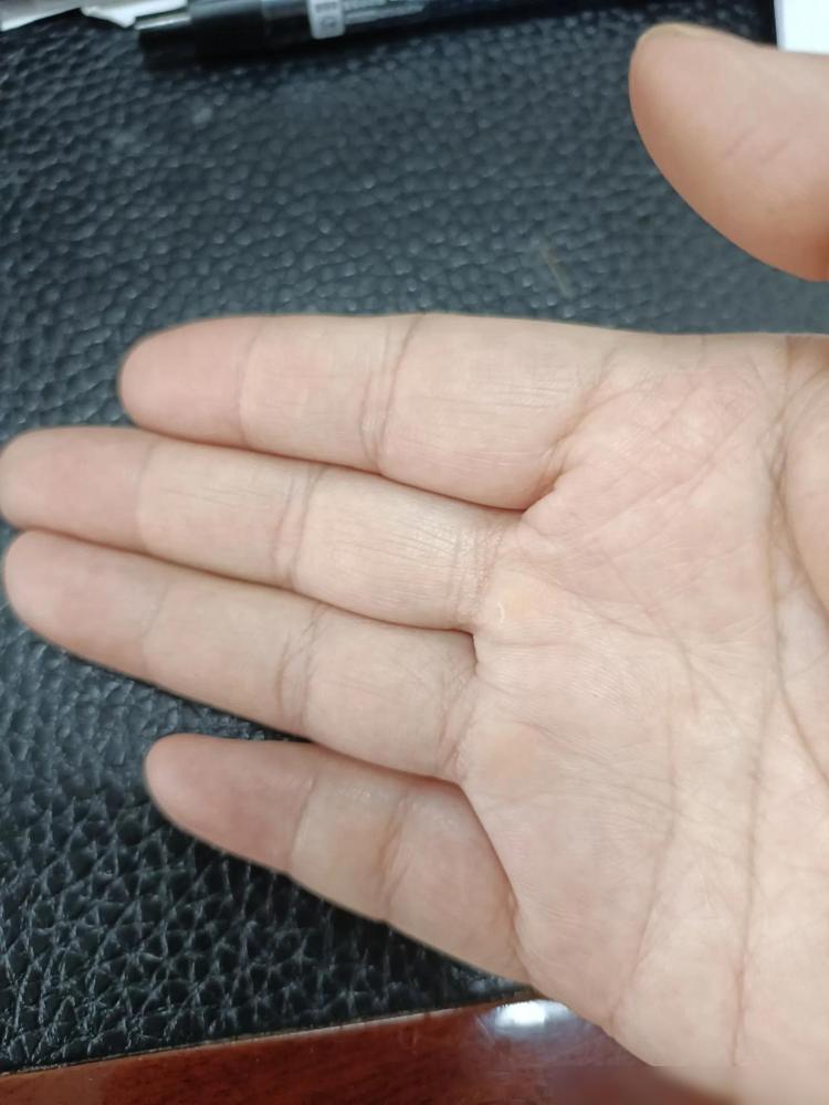 据说十指簸萁的人，是一千人中才能找到一位，一般命运多舛，有很强的感化力，多是因前