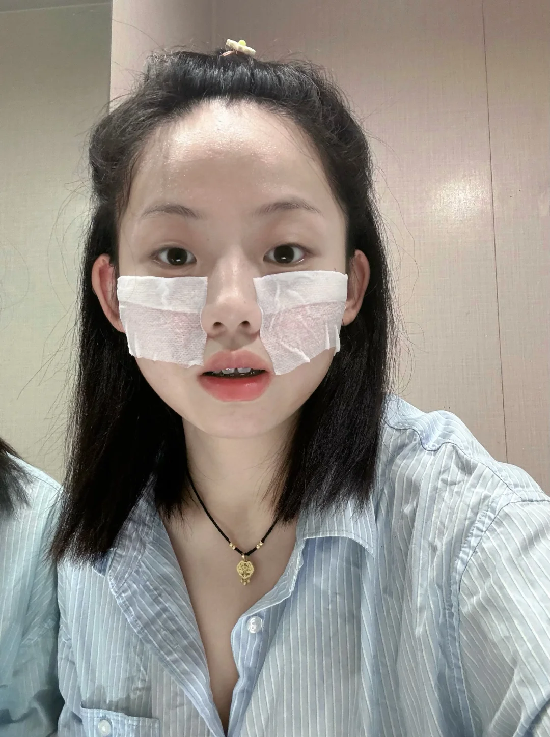 二八湿敷法真的有用吗？