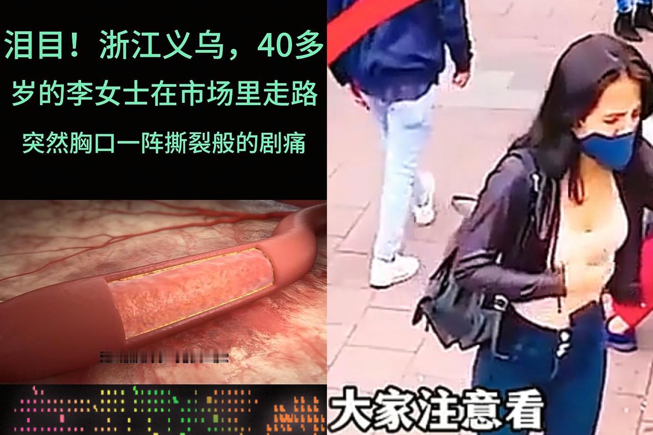 义乌40多岁的李女士逛市场时，胸口突然像被人从里往外狠狠撕开，疼得她当场僵住，第