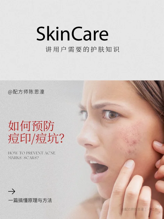 护肤知识｜如何预防痘印/痘坑？