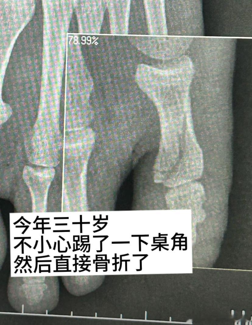 人到了三十岁就变得很脆皮[淡淡的] ​​​