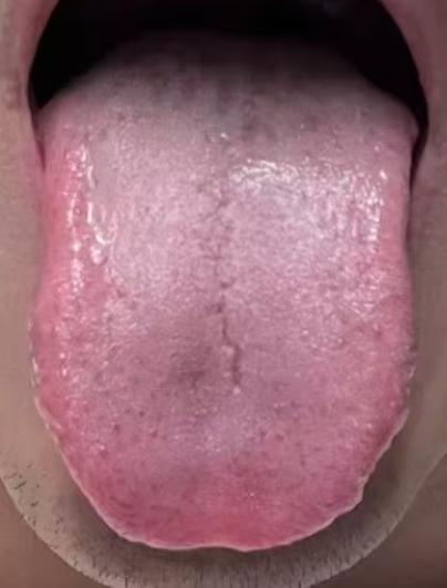 人到中年状态变差，调和脾胃、补足气血尤为关键







有不少上了年纪的男同