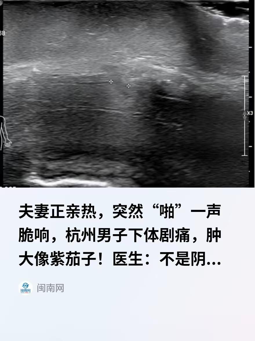 “光听着就疼！”浙江杭州，一49岁男子和妻子同房亲热时，动作猛了些，突然“啪”一