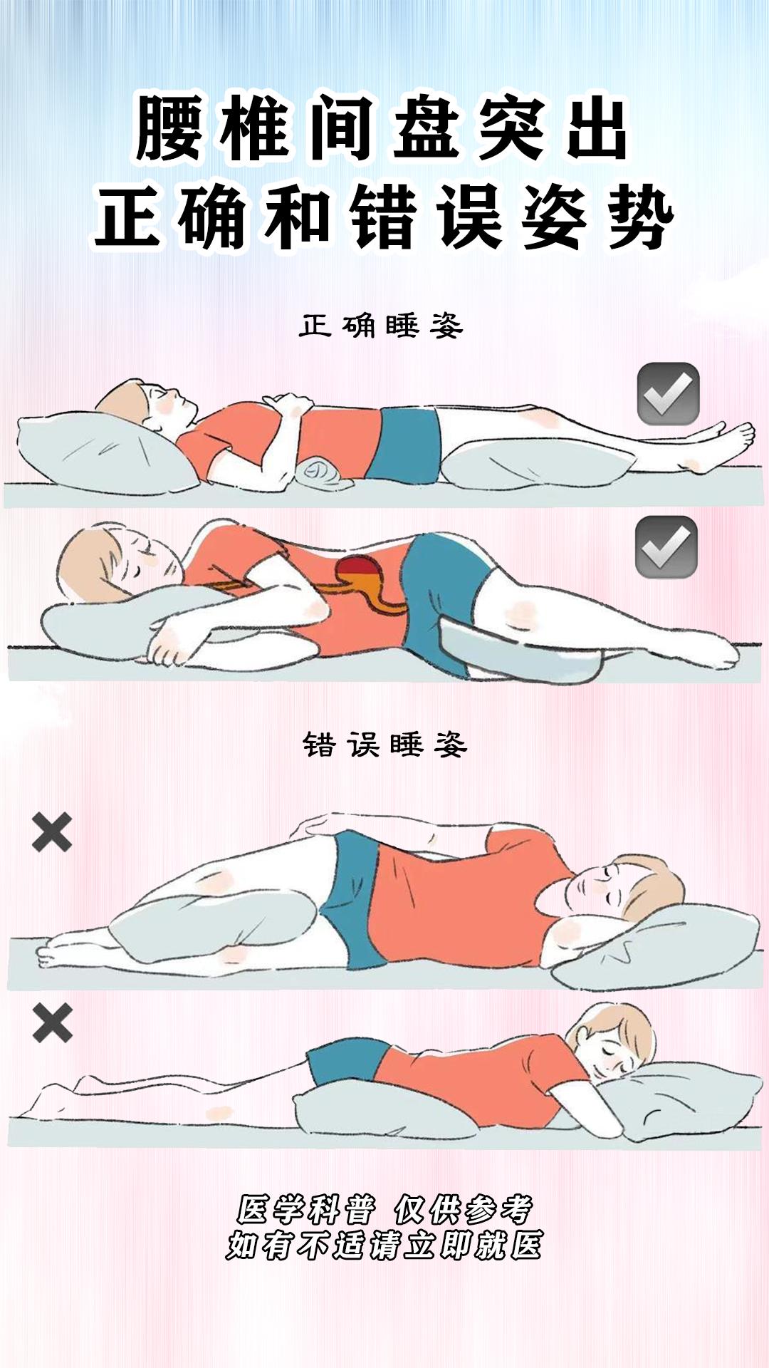 腰椎间盘突出 健康科普