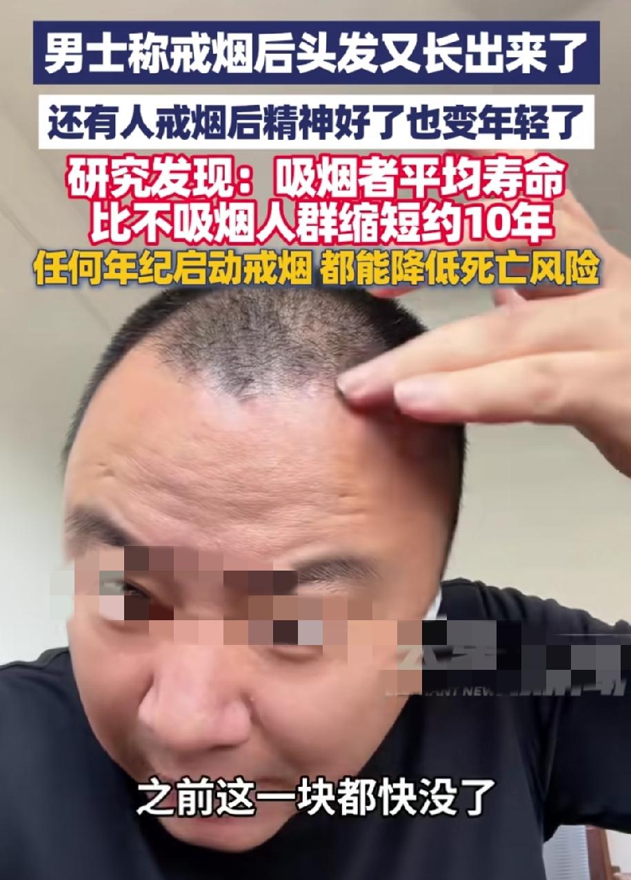 戒烟有这么多好处你知道吗？
陕西一男子分享戒烟后的亲身经历，他说戒烟后原本头顶稀