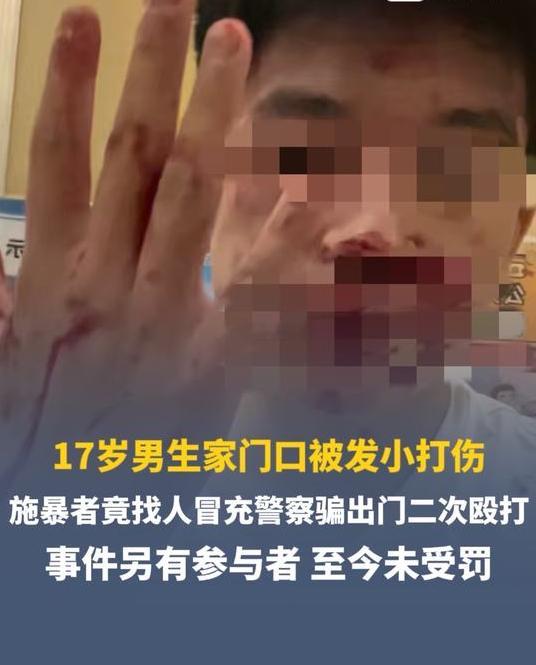 警方提级处理男生报警后再遭施暴 山西运城 17 岁高中生小雷遭人冒充警察骗出小区