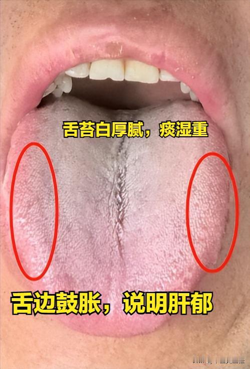 补阳不通阳，白忙活一场！
阳虚的人，就好像是某个地方的物资匮乏了，补阳就是去输送