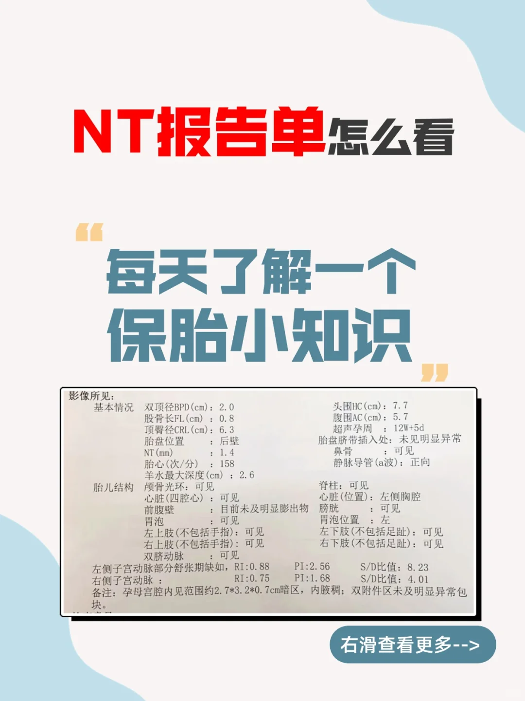 NT报告单怎么看？