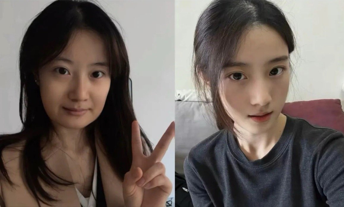 这位“美女”询问，她这小整了一下脸之后，现在算不算是半个顶美了？你们觉得呢？ ​
