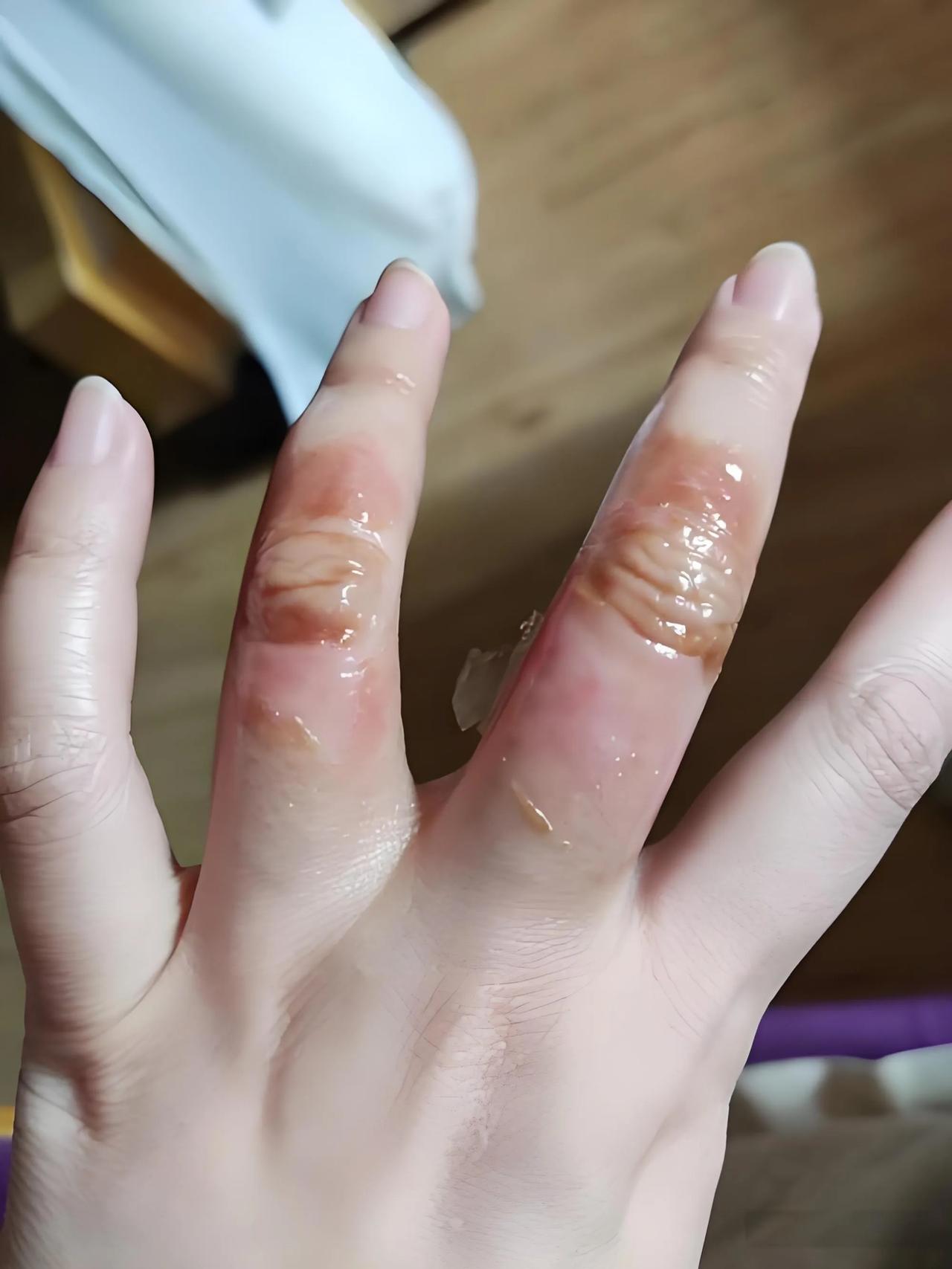 孩子出生三个月时，为了既能够照顾孩子还要生活，我东拼西凑，借钱开了间很小的炸串店