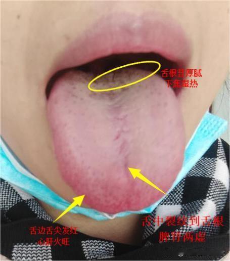 美女啊，你放假到底干嘛了，怎么把自己整的火又大，身体又虚的[震惊][震惊]
这个