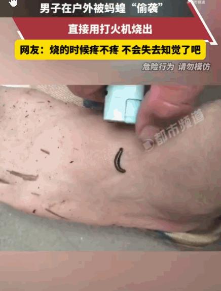 河南，一男子在户外活动时，突然感觉脚背不适，低头一看，竟有一只蚂蟥钻进皮肤，紧紧