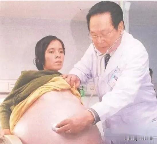 2007年，怀胎12个月的女人，在丈夫的陪同下，挺着巨肚，来到了广州医院检查，没