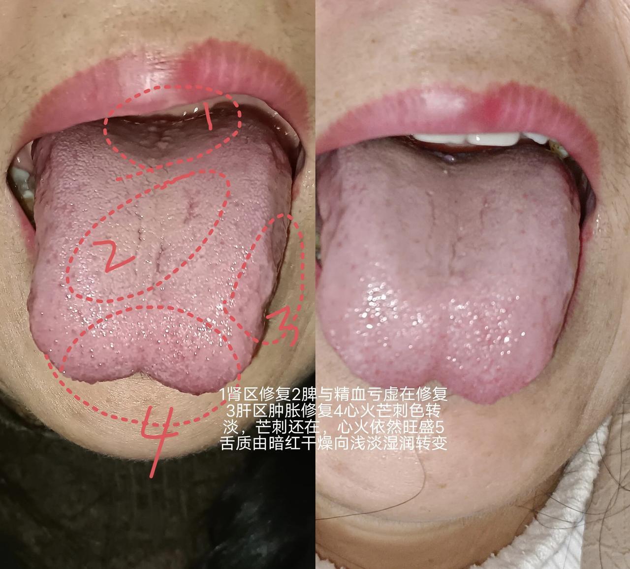 谁都在乎健康，但身体要如何呵护呢？
​想要呵护身体，先要找出影响身体健康的根源，