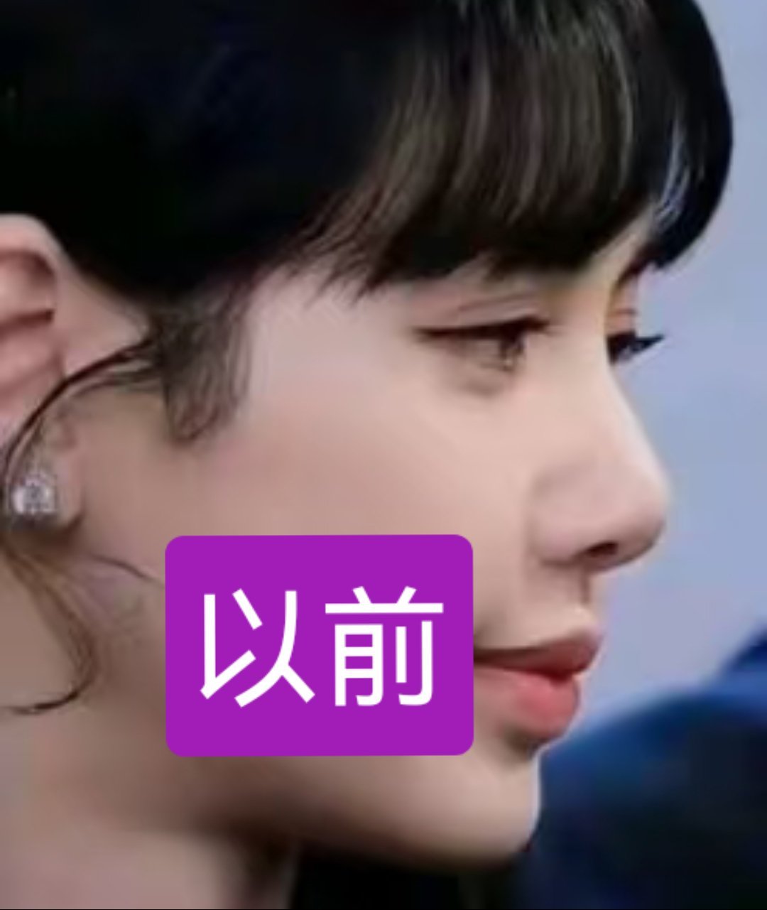 这个鼻子和下巴整的可真明显 