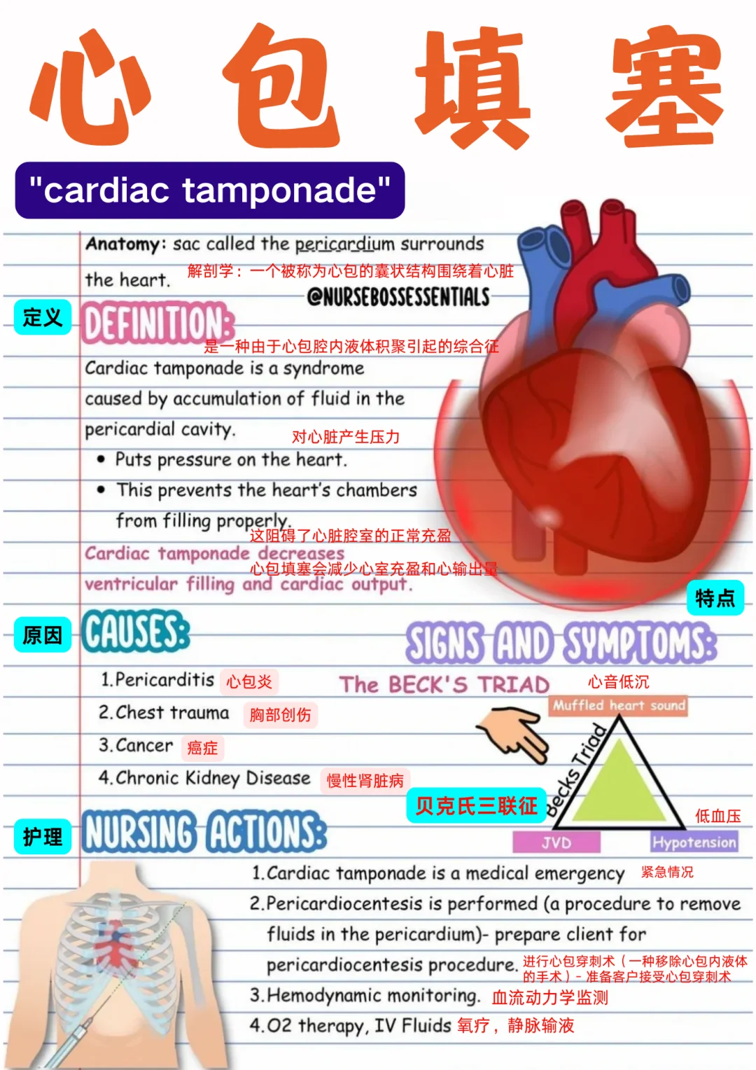 备考RN/心包填塞！！学！！单词